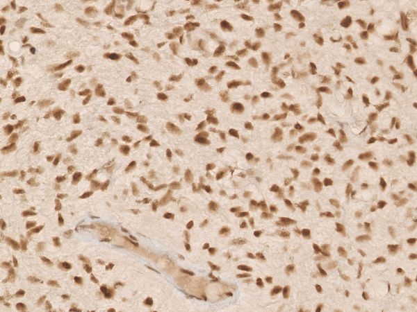 DIA-AX1 Anti-ATRX (Hu) aus Maus (Klon: AX1)