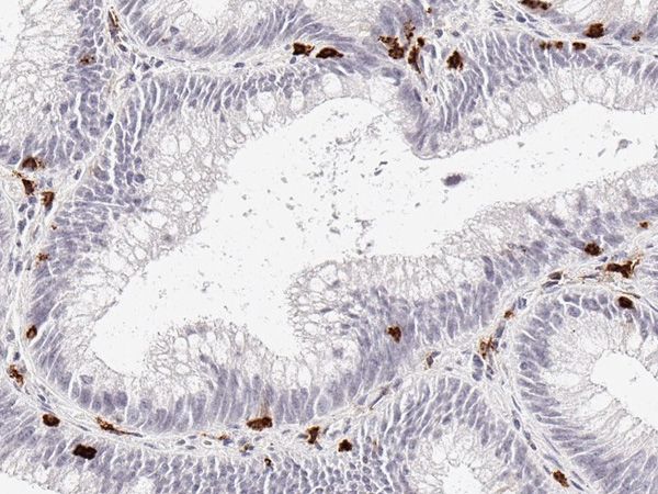 DIA-TC8 Anti-CD8 (Hu) aus Maus (TC8)