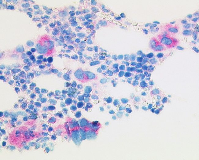DIA-CAL-250 Anti-mutiertes Calreticulin / CALR (Hu)
